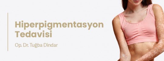 Hiperpigmentasyon Tedavisi